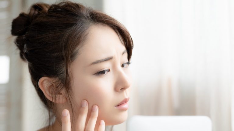 Ingredientes de maquillaje que debes evitar si tienes una piel propensa al acné