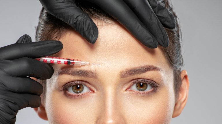 La verdad sobre el Botox preventivo